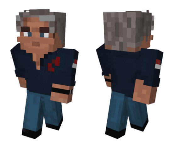 Скин Эпштейна